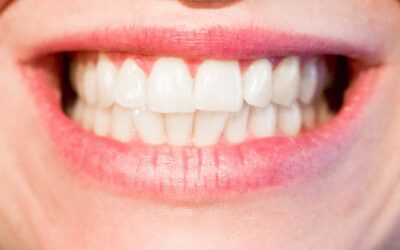 Laser dentale Legnano: una terapia innovativa dal Dottor La Rocca