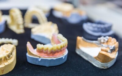 Impianti dentali a Legnano? Il Dott. La Rocca ti può aiutare