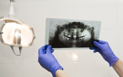 Radiologia dentale a Legnano: diagnostica presso lo studio La Rocca