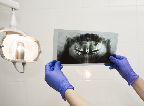 Radiologia dentale a Legnano: diagnostica presso lo studio La Rocca